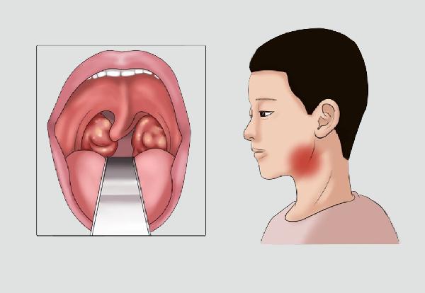 固元膏的食用方法    哪些不宜食用固元膏